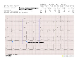 Cardea 20/20 ECG Library | Cardiac Insight